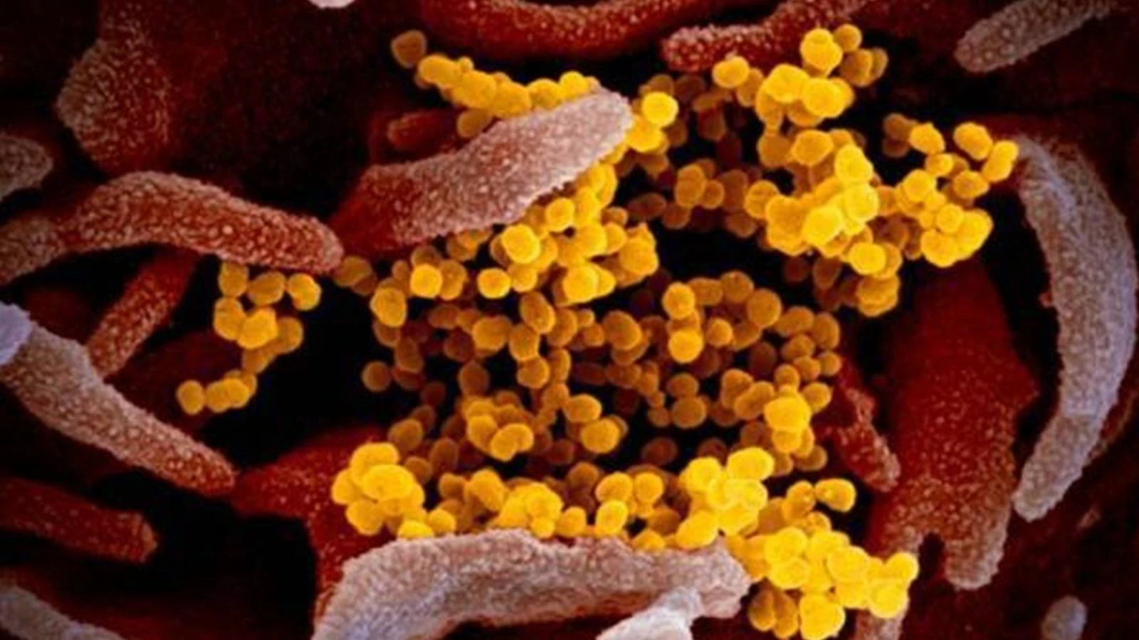 Is your Covid shot still effective against new BA.3.2 variant? Here’s what we know so far