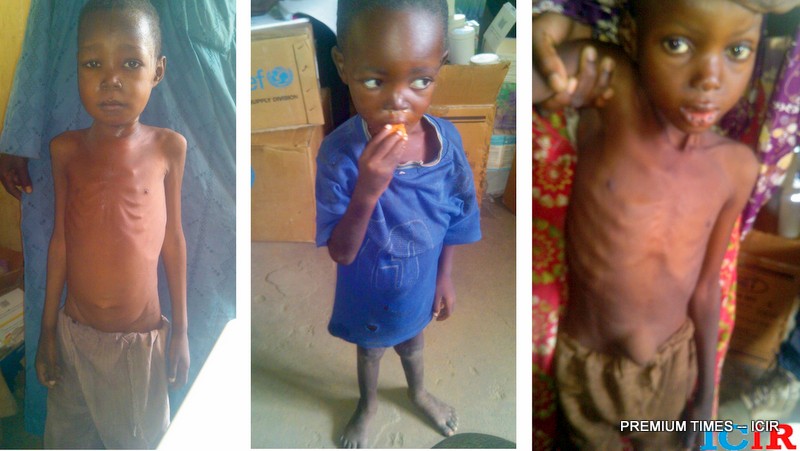 Malnourished children