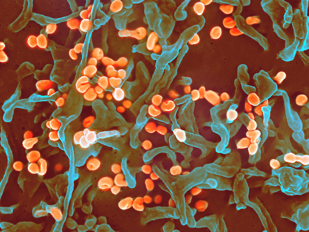 Lassa fever virus